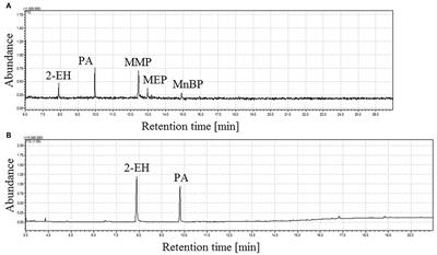 Advancement in Determination of Phthalate Metabolites by Gas Chromatography Eliminating Derivatization Step